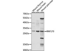 Western blot analysis of extracts of various cell lines, using RNF170 antibody (ABIN7270064) at 1:1000 dilution. (RNF170 antibody  (AA 46-120))