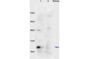 Lane 1: mouse kidney lysates Lane 2: mouse embryo lysates probed with Anti phospho-eIF4EBP1/4EBP1(Ser64) Polyclonal Antibody, Unconjugated (ABIN682963) at 1:200 in 4 °C.
