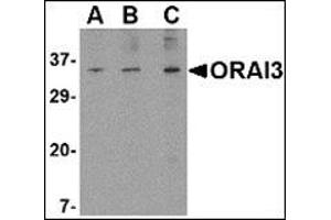 Western blot analysis of ORAI3 in A20 cell lysate with this product at (A) 1, (B) 2 and (C) 4 μg/ml.