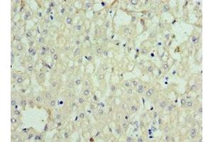 Immunohistochemistry of paraffin-embedded human liver tissue using ABIN7168634 at dilution of 1:100 (Sclerostin antibody  (AA 24-213))