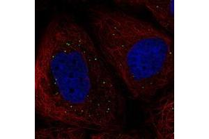 Immunofluorescent staining of human cell line A-431 with KCNG1 polyclonal antibody  at 1-4 ug/mL dilution shows positivity in vesicles. (KCNG1 antibody)