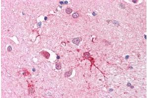 Human Brain, Basal Ganglia (SLC1A4 antibody  (C-Term))