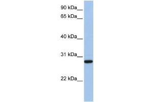 Western Blotting (WB) image for anti-Voltage-Dependent Anion Channel 3 (VDAC3) antibody (ABIN2458132) (VDAC3 antibody)