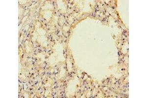 Immunohistochemistry of paraffin-embedded human lung tissue using ABIN7142685 at dilution of 1:100
