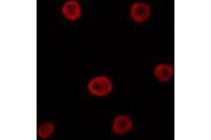 ABIN6275800 staining HepG2 by IF/ICC. (GATA6 antibody  (Internal Region))