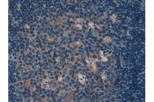 Detection of IL2Ra in Mouse Lymph node Tissue using Polyclonal Antibody to Interleukin 2 Receptor Alpha (IL2Ra) (CD25 antibody  (AA 22-235))