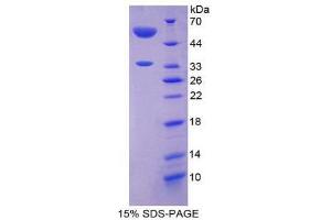 SDS-PAGE (SDS) image for Angiopoietin-Like 4 (ANGPTL4) (AA 182-388) protein (His tag,GST tag) (ABIN2122405)
