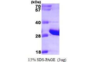SDS-PAGE (SDS) image for Fas (TNFRSF6)-Associated Via Death Domain (FADD) (AA 1-208) protein (His tag) (ABIN667749)