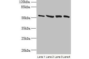 Western blot All lanes: CCDC112 antibody at 12 μg/mL Lane 1: Jurkat whole cell lysate Lane 2: Hela whole cell lysate Lane 3: HepG2 whole cell lysate Lane 4: A549 whole cell lysate Secondary Goat polyclonal to rabbit IgG at 1/10000 dilution Predicted band size: 54, 62 kDa Observed band size: 54 kDa (CCDC112 antibody  (AA 201-446))