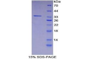 SDS-PAGE analysis of Mouse CARD9 Protein. (CARD9 Protein)