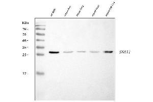 Western blot analysis of SNAIL/SNAI1 using anti-SNAIL/SNAI1 antibody (ABIN7599028). (SNAIL antibody  (AA 1-170))