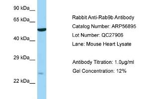 Western Blotting (WB) image for anti-RAB9B, Member RAS Oncogene Family (RAB9B) (N-Term) antibody (ABIN2786963) (RAB9B antibody  (N-Term))
