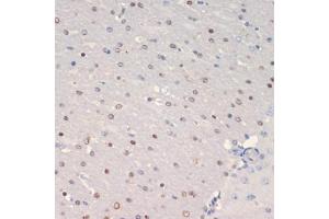 Immunohistochemistry of paraffin-embedded mouse brain using Olig2 antibody (ABIN6128396, ABIN6145015, ABIN6145016 and ABIN6216575) at dilution of 1:200 (40x lens). (OLIG2 antibody  (AA 1-80))