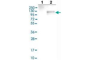 Western blot analysis of Lane 1: Negative control (vector only transfected HEK293T lysate), Lane 2: Over-expression lysate (Co-expressed with a C-terminal myc-DDK tag (~3. (Cadherin 13 antibody  (AA 567-711))