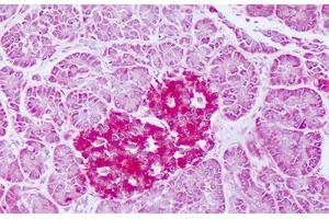 Image no. 1 for anti-Ferritin, Mitochondrial (FTMT) (AA 98-147) antibody (ABIN6749792) (Ferritin Mitochondrial antibody  (AA 98-147))