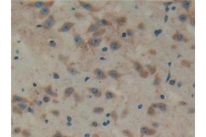 Detection of TXLNa in Mouse Cerebrum Tissue using Polyclonal Antibody to Taxilin Alpha (TXLNa) (alpha Taxilin antibody  (AA 1-234))