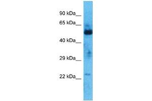 Host:  Rabbit  Target Name:  ZNF772  Sample Type:  Thymus Tumor lysates  Antibody Dilution:  1. (ZNF772 antibody  (N-Term))