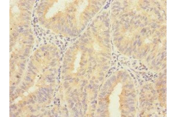 ZNF582 antibody  (AA 1-300)