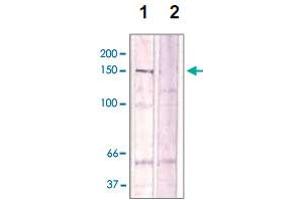 The cell lysate derived from Conditioned NIH/3T3 cell was immunoprecipitated by ROCK2 (phospho T396) polyclonal antibody , then immunoprobed by the same antibody at 1 : 500 (lane 1). (ROCK2 antibody  (pThr396))