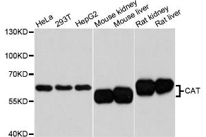 Western blot analysis of extracts of various cell lines, using CAT antibody. (Catalase antibody)