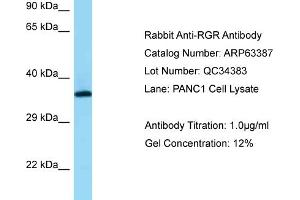 Western Blotting (WB) image for anti-Retinal G Protein Coupled Receptor (RGR) (N-Term) antibody (ABIN2774370) (RGR antibody  (N-Term))