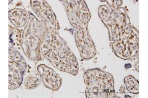 Immunoperoxidase of monoclonal antibody to ADAMTS17 on formalin-fixed paraffin-embedded human placenta.