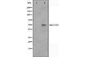 Western blot analysis on Jurkat cell lysate using ZIC1/2/3 Antibody,The lane on the left is treated with the antigen-specific peptide. (ZIC1/2/3 antibody)