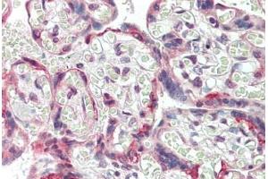 Human, Placenta:Formalin-Fixed Paraffin-Embedded (FFPE)