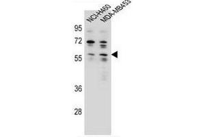 ANKRD34C Antibody (C-term) western blot analysis in NCI-H460,MDA-MB453 cell line lysates (35µg/lane). (ANKRD34C antibody  (C-Term))