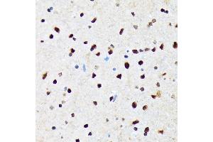 Immunohistochemistry of paraffin-embedded rat brain using CAMKIV Rabbit mAb (ABIN7266021) at dilution of 1:100 (40x lens). (CAMK4 antibody)