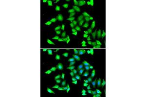 Immunofluorescence analysis of A549 cell using GSTCD antibody. (GSTCD antibody)