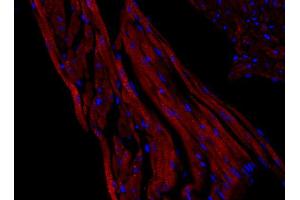 Immunohistochemistry (IHC) image for anti-Solute Carrier Family 2 (Facilitated Glucose Transporter), Member 4 (SLC2A4) (AA 495-509) antibody (ABIN1742482) (GLUT4 antibody  (AA 495-509))