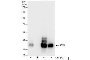 Immunoprecipitation (IP) image for anti-SRY (Sex Determining Region Y)-Box 2 (SOX2) antibody (ABIN2855074)
