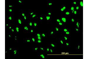 Immunofluorescence of monoclonal antibody to UBTF on HepG2 cell. (UBTF antibody  (AA 551-650))