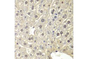 Immunohistochemistry of paraffin-embedded mouse liver using NR3C1 antibody at dilution of 1:200 (400x lens). (Glucocorticoid Receptor antibody)