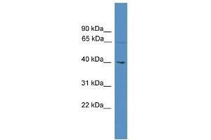 WB Suggested Anti-UTP18 Antibody Titration: 0. (UTP18 antibody  (N-Term))