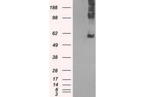 Image no. 2 for anti-Solute Carrier Family 7 (Amino Acid Transporter, L-Type), Member 8 (SLC7A8) antibody (ABIN1500964) (SLC7A8 antibody)