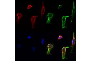 ABIN6258278 and ABIN6273860 staining Hela cells by IF/ICC.