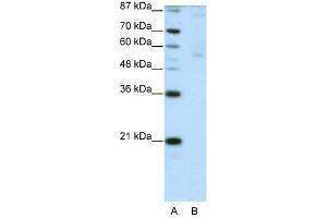 ZNF92 antibody (20R-1238) used at 0. (ZNF92 antibody  (C-Term))