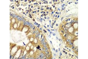 Immunohistochemistry of paraffin-embedded Human colon using PICK1 Polyclonal Antibody at dilution of 1:100 (40x lens). (PICK1 antibody)