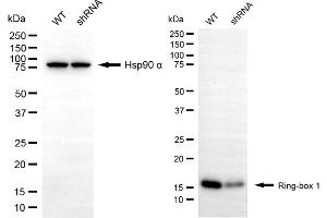 Western blotting analysis using ring-box 1 antibody (ABIN7800253).