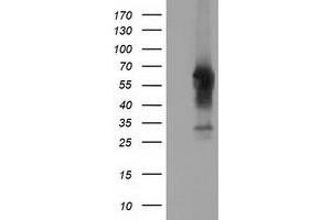 HEK293T cells were transfected with the pCMV6-ENTRY control (Left lane) or pCMV6-ENTRY CD5 (Right lane) cDNA for 48 hrs and lysed. (CD5 antibody)