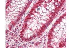 Human Colon: Formalin-Fixed, Paraffin-Embedded (FFPE). (MAT2A antibody  (Internal Region))