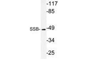 Western blot analysis of SSB antibody in extracts from 293 cells. (SSB antibody)