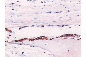 Immunohistochemistryimageof Osteopontin staining in paraffin section of fetal calvaria. (Osteopontin antibody  (AA 59-74))