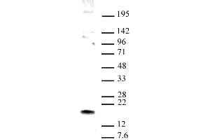 HMGN1 antibody (pAb) tested by Western blot. (HMGN1 antibody  (C-Term))
