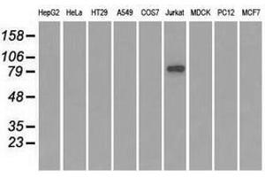 Image no. 2 for anti-SATB Homeobox 1 (SATB1) antibody (ABIN1500812) (SATB1 antibody)