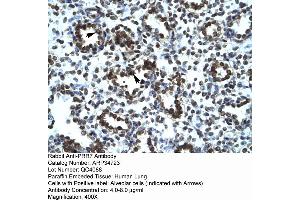 Human Lung (PRR7 antibody  (Middle Region))