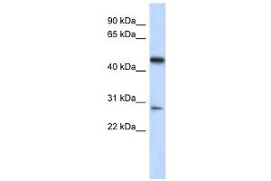 C13ORF31 antibody used at 1 ug/ml to detect target protein. (LACC1 antibody  (Middle Region))