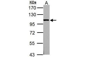 WB Image Sample (30 ug of whole cell lysate) A: PC-12 7. (ACTN3 antibody  (Center))